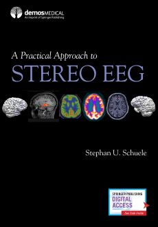 A Practical Approach to Stereo EEG image
