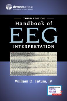 Handbook of EEG Interpretation image