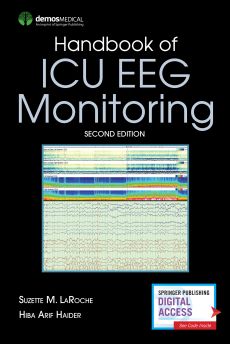 Handbook of ICU EEG Monitoring image
