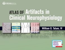 Atlas of Artifacts in Clinical Neurophysiology image