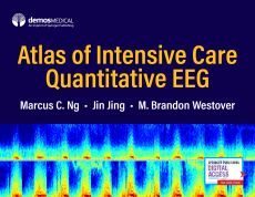 Atlas of Intensive Care Quantitative EEG image