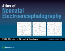 Atlas of Neonatal Electroencephalography image