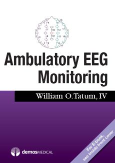 Ambulatory EEG Monitoring image