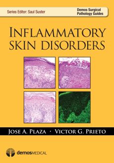 Inflammatory Skin Disorders image