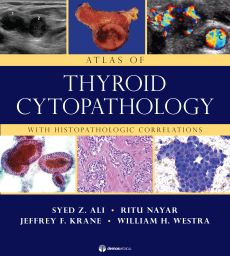 Atlas of Thyroid Cytopathology image