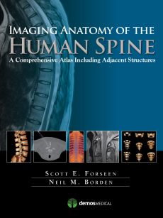 Imaging Anatomy of the Human Spine image