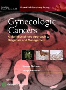 Gynecologic Cancers image