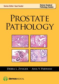 Prostate Pathology image
